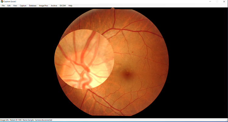 Magnifying glass function